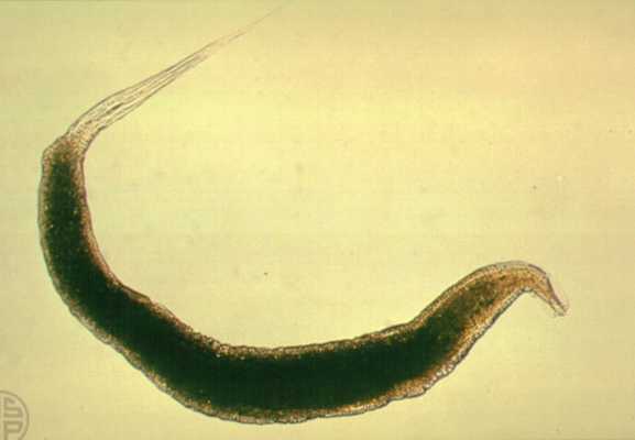 Les artropodes paraziti de l homme - Enterobius vermicularis female and male
