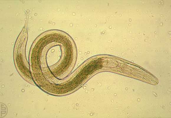 enterobius vermicularis oxiuros pinworms látható a székletben