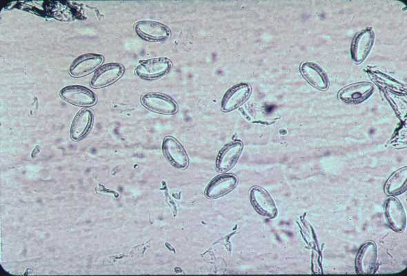 Enterobius vermicularis lijecenje