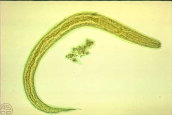 Intestinal Nematodes