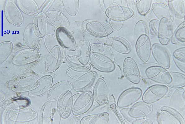 Enterobius vermicularis graham, Enterobius vermicularis (oxiurii)