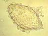 Schistosomahaematobium189.jpg