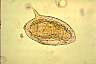 Schistosomamansoni186.jpg