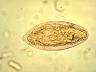 Schistosomamansoni187.jpg