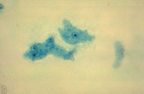 naegleria-fowleri