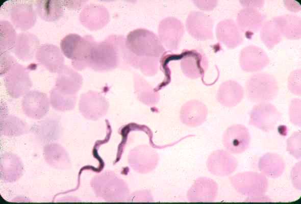 Trypanosoma Brucei Ssp 